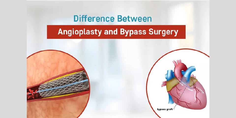 Dr Bhishma Chowdary cardiologist in Hyderabad