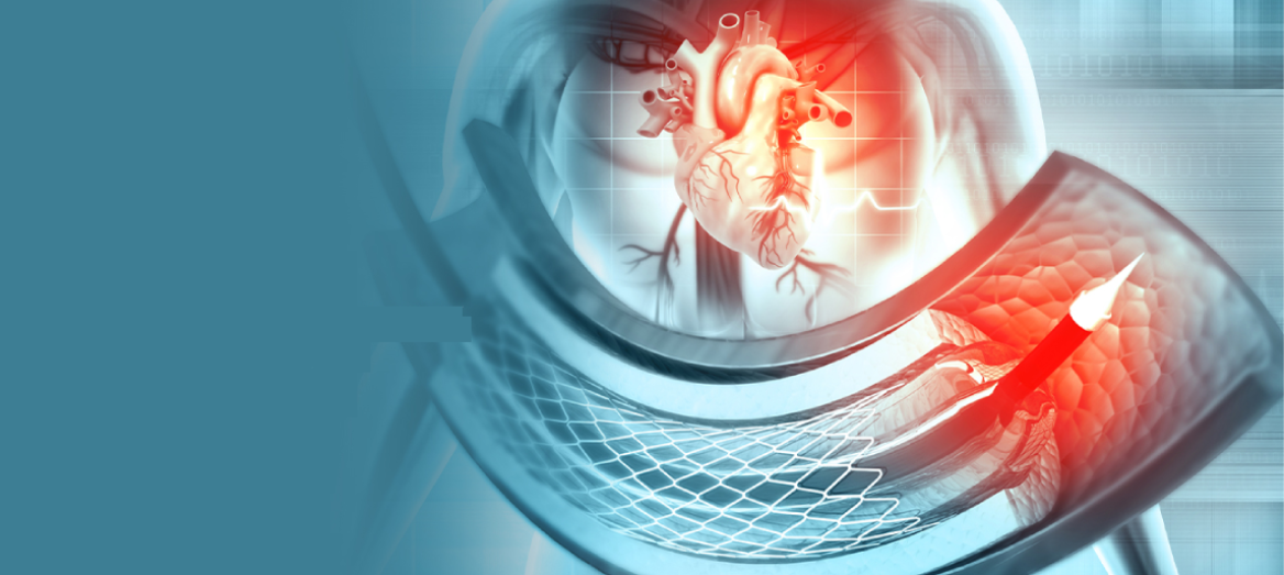 coronary-angiogram-test-in-hyderabad